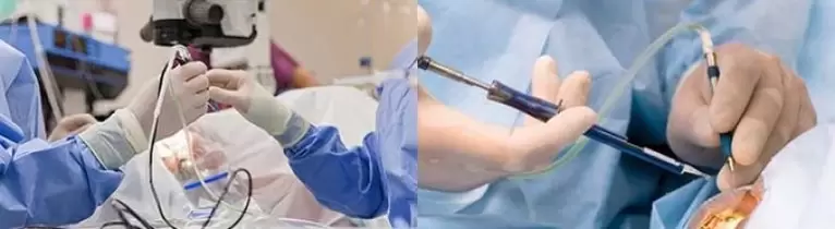 Görmeyi düzeltmek için ameliyat